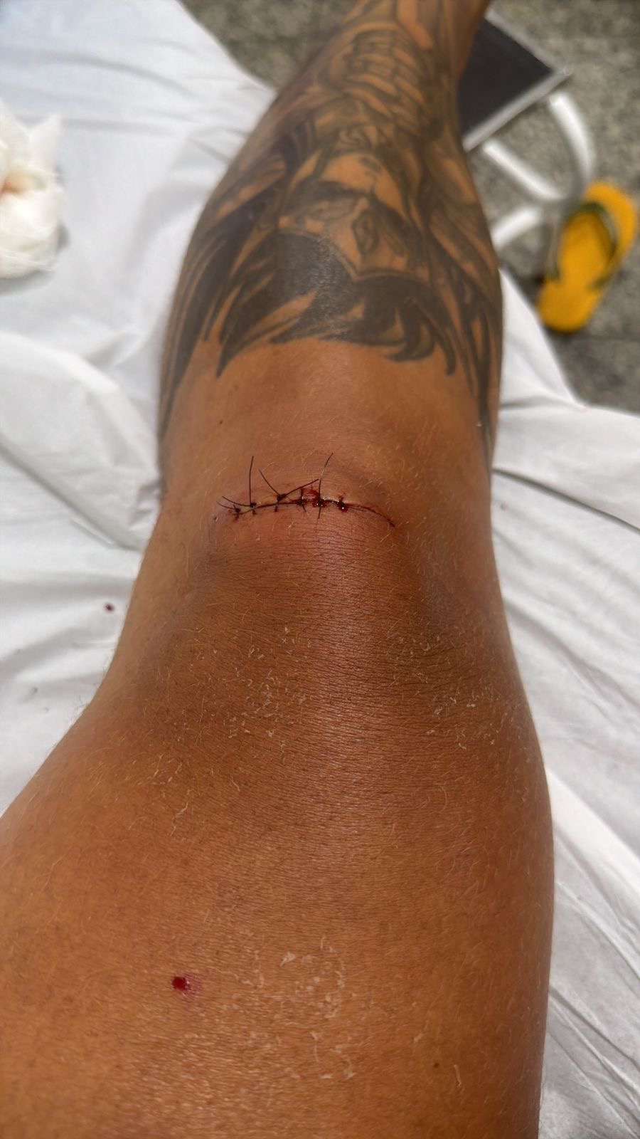 Lorena consultando chat gpt com joelho aberto 